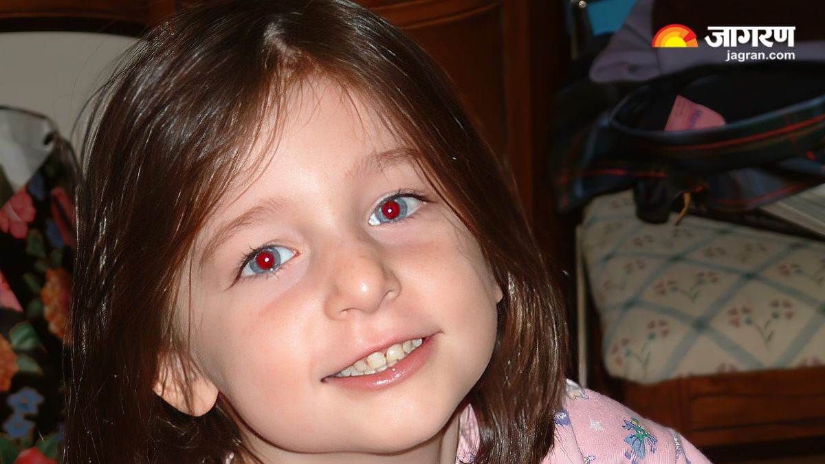 https://www.jagranimages.com/images/newimg/15122024/15_12_2024-why_do_eyes_turn_red_in_photos_23849089.jpg