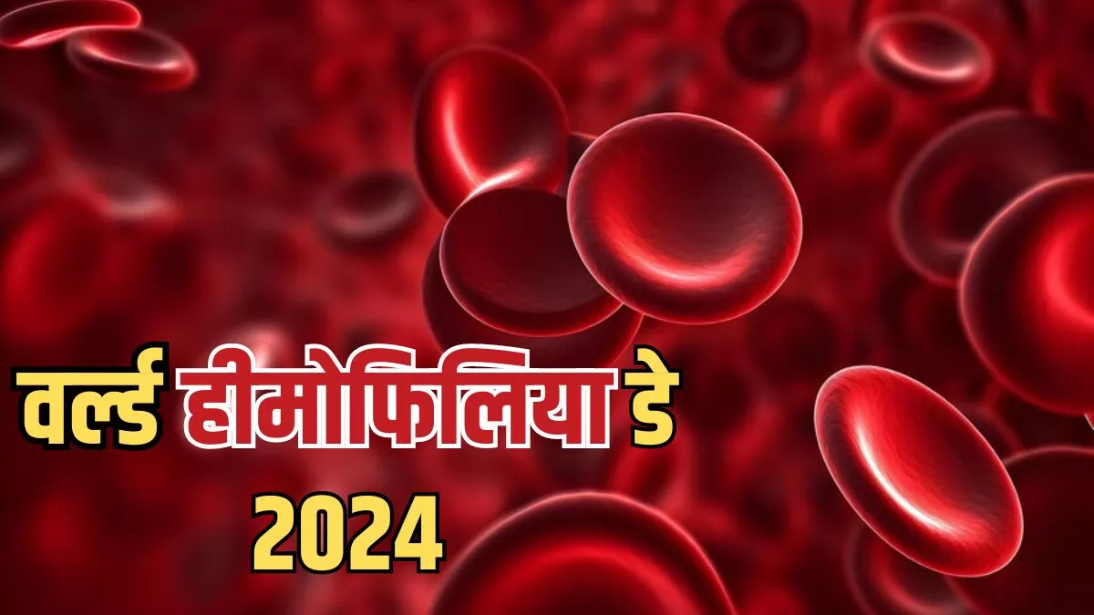 World Hemophilia Day 2024: क्या है हीमोफिलिया जो बन सकता है ब्लीडिंग का कारण, एक्सपर्ट से जानें इसके बारे में सबकुछ