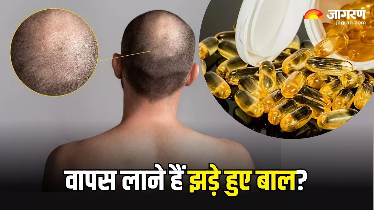 Hair Growth: बढ़ती उम्र में नहीं होना चाहते गंजेपन का शिकार, तो डाइट में शामिल करें ये 5 जरूरी मिनरल्स