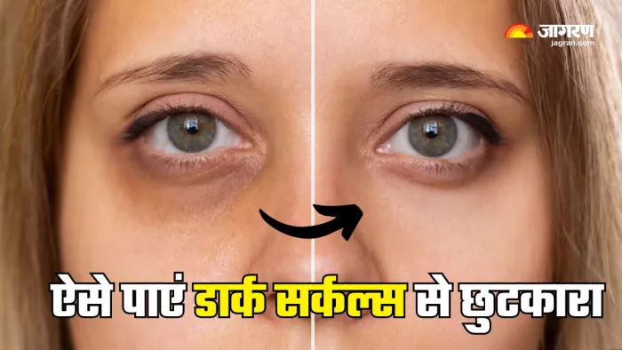 ये तेल दिलाएं Dark Circles से छुटकारा (Picture Courtesy: Freepik)