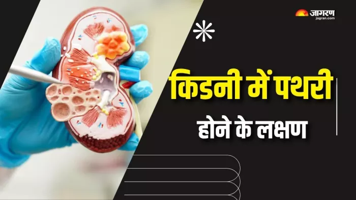किडनी स्टोन्स के इन लक्षणों से रहें सावधान! (Picture Courtesy: Freepik)