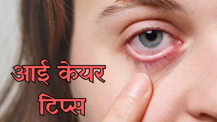 मानसून में होने वाली आई एलर्जी और उनसे बचने के उपाय