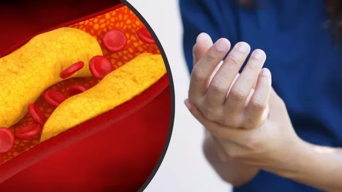 High Cholesterol के इन लक्षणों को न करें नजरअंदाज (Image Credit- Freepik)