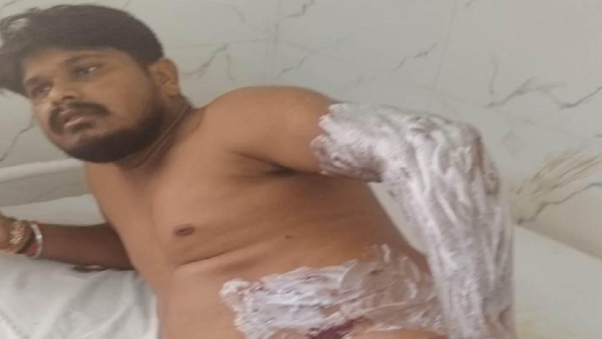 https://www.jagranimages.com/images/newimg/16082025/16_08_2025-injured_24014855.jpg