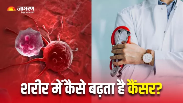 कैंसर की शुरुआत कैसे होती है? डॉक्टर से समझें कैंसर के सभी स्टेज (Image Source: Freepik)