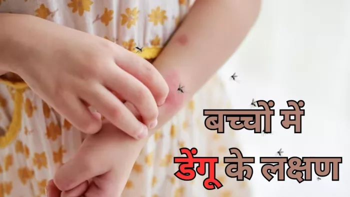 बच्चों के डेंगू का संकेत होते हैं ये लक्षण