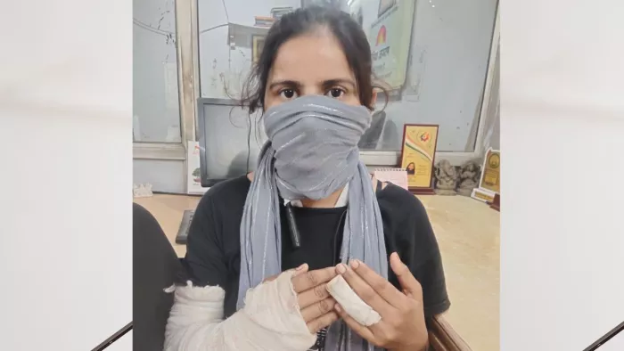 पति की मारपीट से घायल पत्नी। फोटो- जागरण