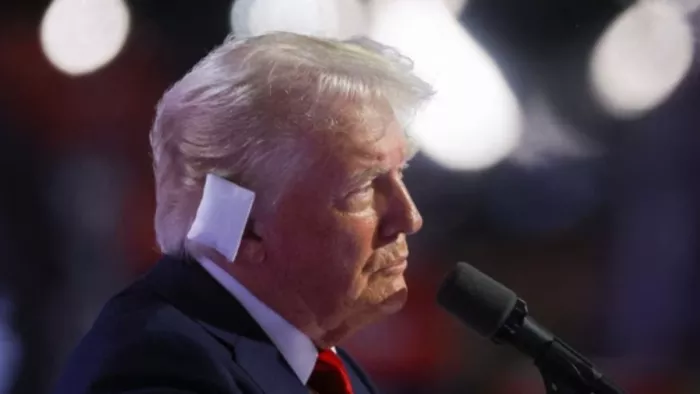 Donald Trump पर हुआ हमला, बाल-बाल बचे।
