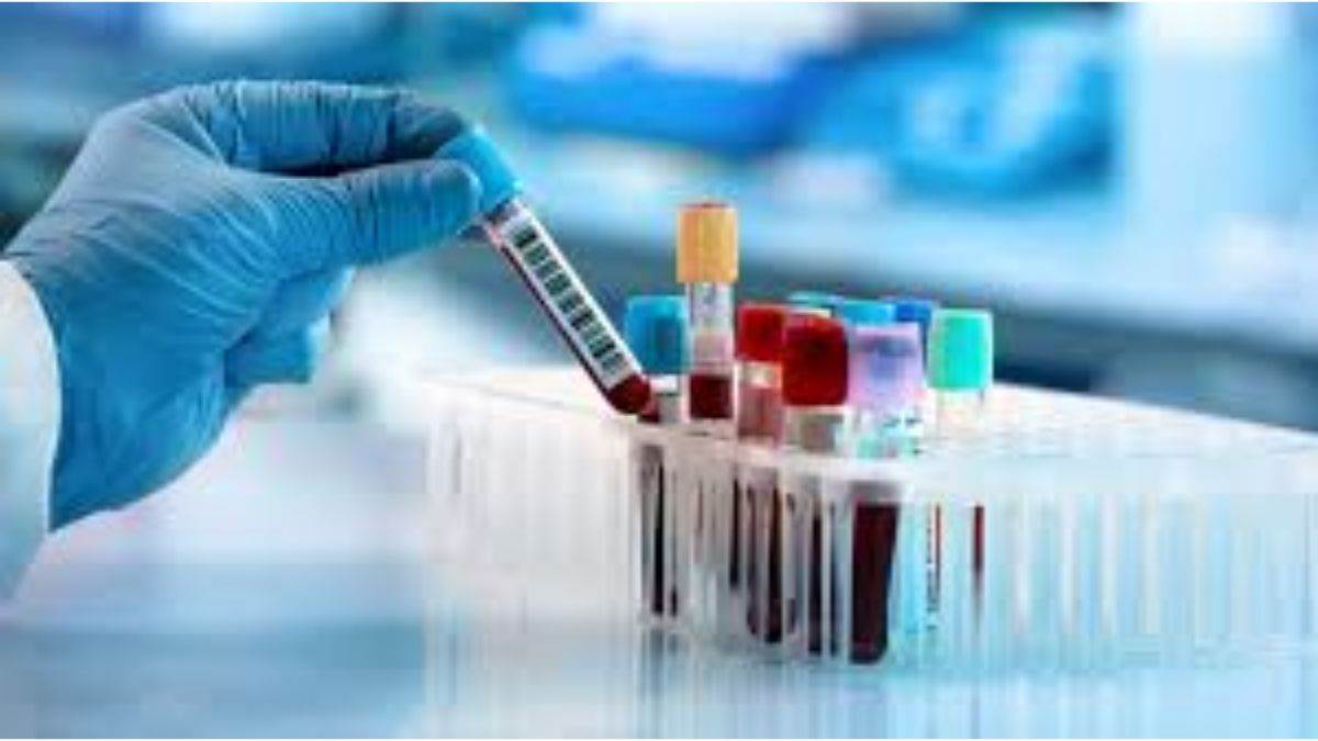 https://www.jagranimages.com/images/newimg/16092025/16_09_2025-free_pathology_tests_24048468.jpg