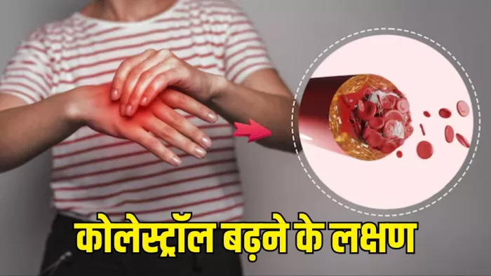 Cholesterol बढ़ने पर नजर आते हैं ये सामान्य लक्षण (Picture Courtesy: Freepik)