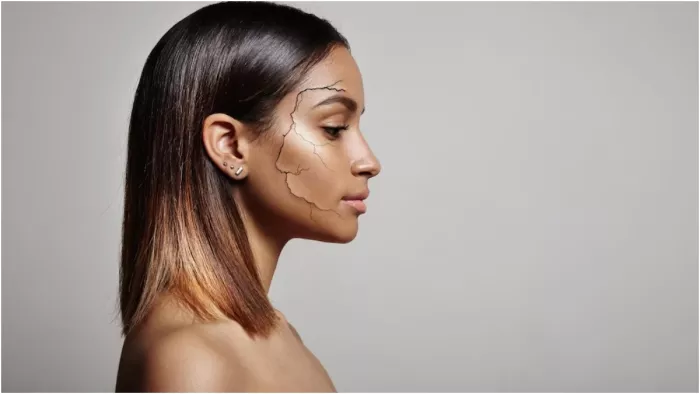 Dry Skin Treatment: गर्मी में भी बेहद जरूरी है रूखी त्वचा की देखभाल, इन घरेलू उपचार से पाएं हेल्दी स्किन