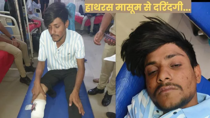मासूम से दरिंदगी का आरोपित अमन खां पुलिस की गोली से हुआ घायल।