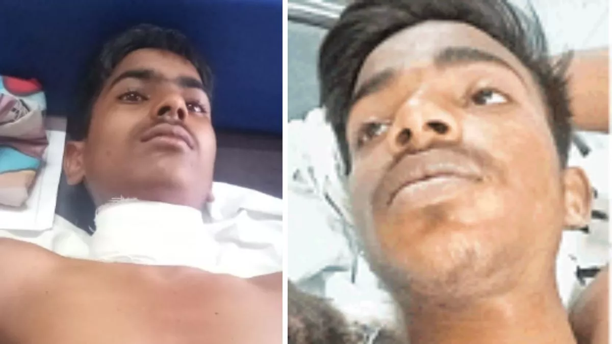 Kushinagar News: रामलीला देखने के दौरान मामूली बात को लेकर हुआ विवाद, मनबढ़ों ने दो किशोरों का गला रेता