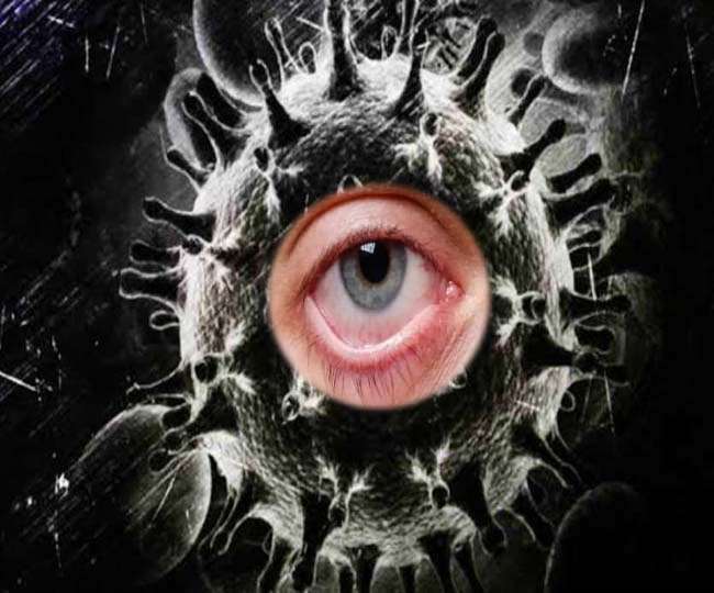 कोरोना से ठीक होने पर चीजें दोदो दिखें तो हो सकता है Black Fungus