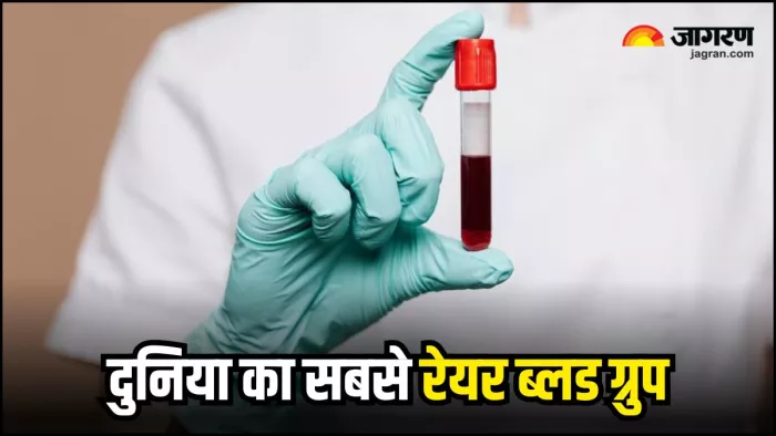 दुनियाभर में सबसे ज्यादा रेयर है 'गोल्डन ब्लड ग्रुप' (Image Source: Freepik)
