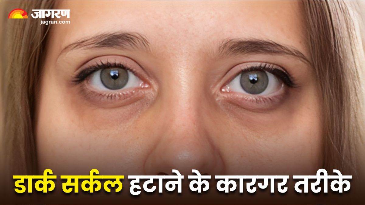https://www.jagranimages.com/images/newimg/17062024/17_06_2024-how_to_remove_dark_circles_23741086.jpg