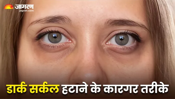 इन दो तरीकों से हटा सकते हैं जिद्दी से जिद्दी Dark Circles (Image Source: Freepik)