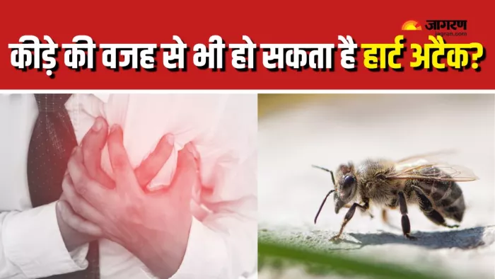 Heart Attack और Allergic Reaction में समझें कनेक्शन (Picture Courtesy: Freepik)