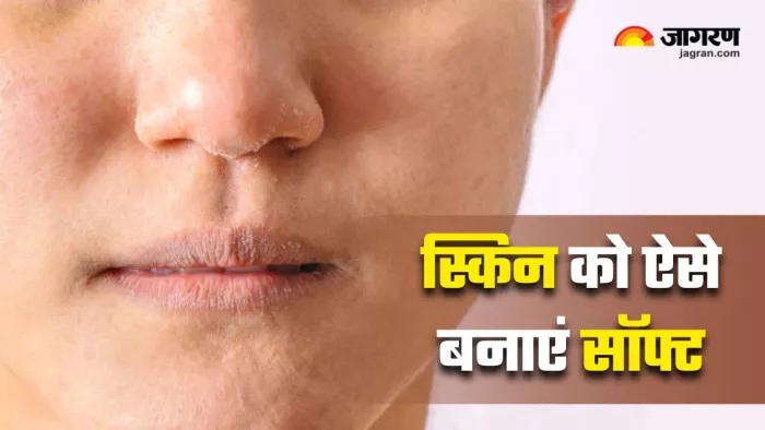 गर्मियों में फॉलो करें 3 टिप्स, नहीं होगी ड्राई स्किन की परेशानी (Image Source: Freepik)