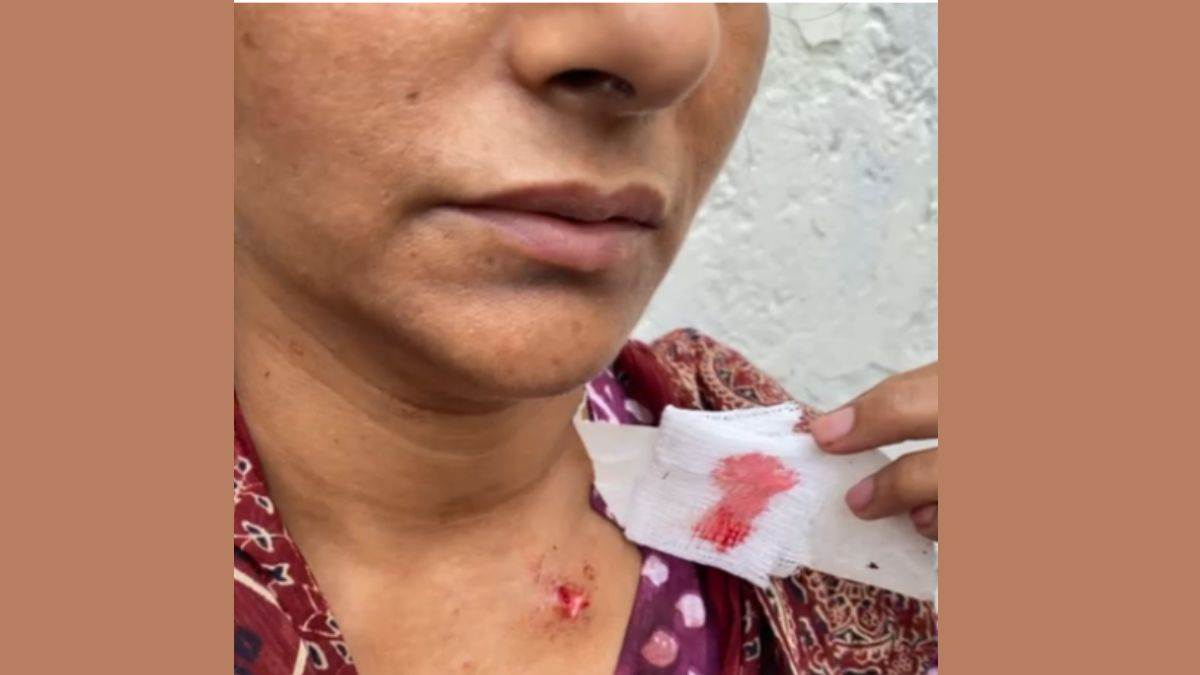 ncr fight between two couples in road rage in greater noida
