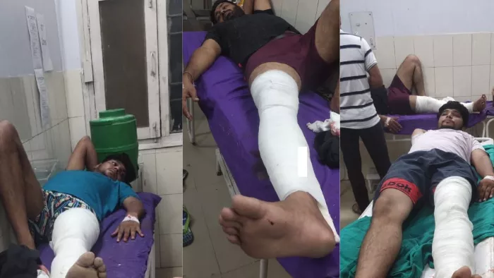 रविंद्र सैनी के हत्यारों की STF के साथ हुई मुठभेड़