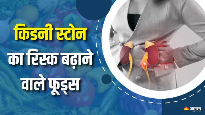 ये फूड्स बढ़ा देते हैं किडनी स्टोन्स का रिस्क (Picture Courtesy: Freepik)