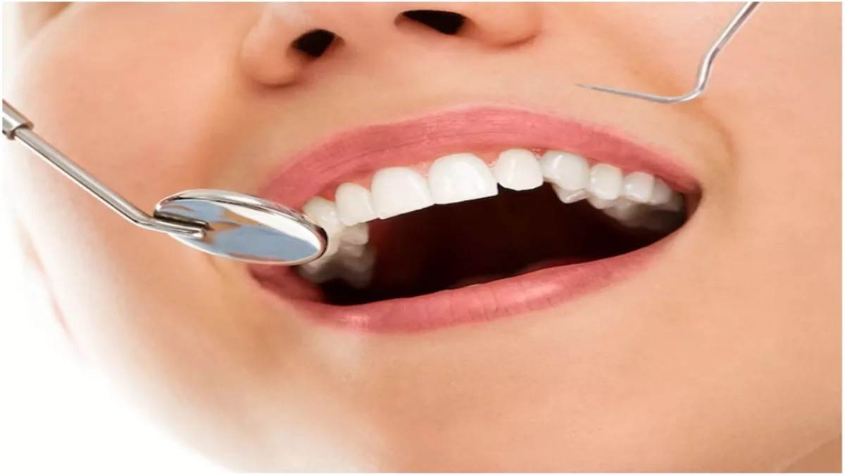 Teeth care tips: दांतों को रखना चाहते हैं साफ और स्वस्थ, तो इन चीजों का बिल्कुल न करें सेवन