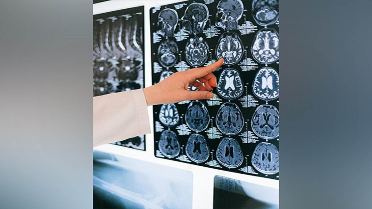 https://www.jagranimages.com/images/newimg/17082022/17_08_2022-brain_22986501.jpg