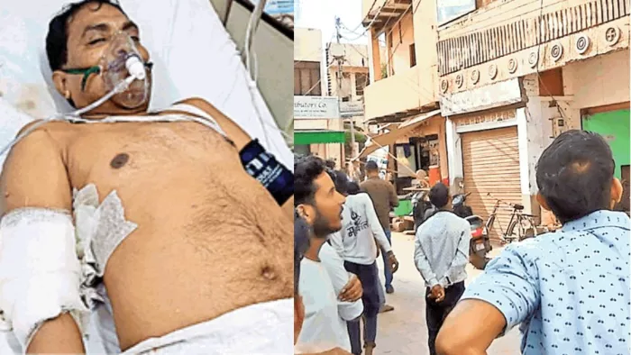 दिनदहाड़े भाजपा नेता पर दागी गईं गोलियां, हमलावर के दोनों हाथ में थे तमंचे; घटना CCTV में कैद