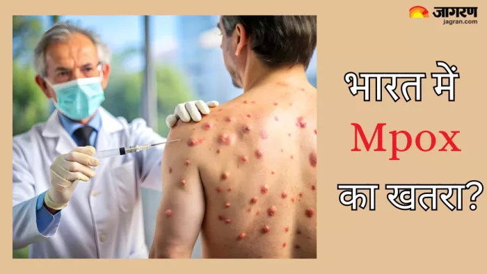 भारत में Mpox का कितना खतरा (Picture Credit- Freepik)