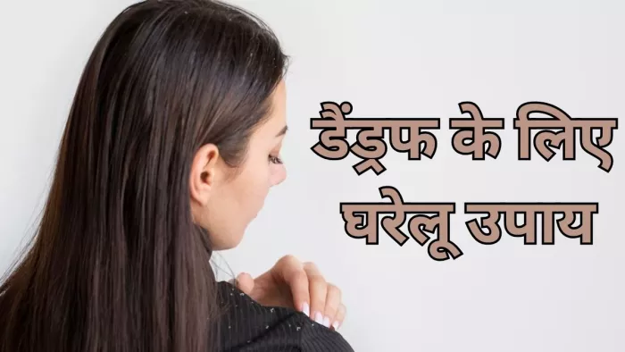 डैंड्रफ की समस्या से राहत दिलाएंगे ये घरेलू उपाय