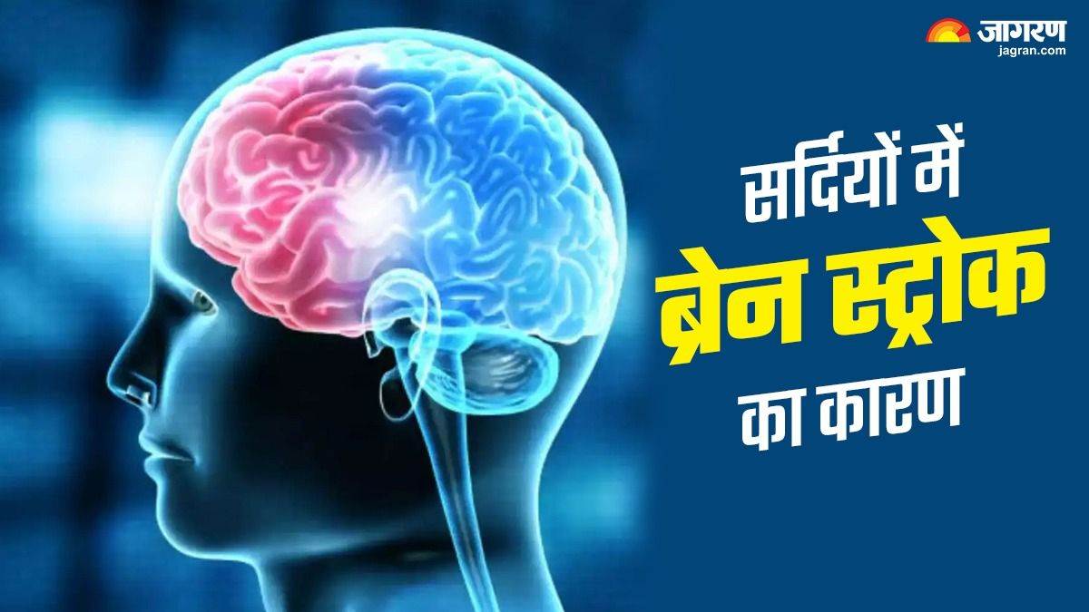https://www.jagranimages.com/images/newimg/17112024/17_11_2024-brain_stroke_23832620.jpg