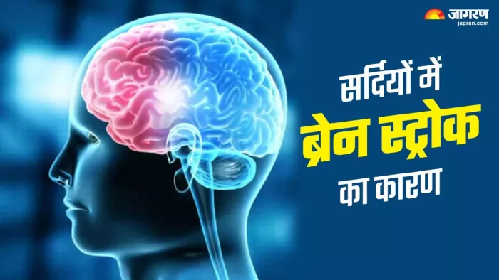 ठंड शुरू हाेते ही बढ़ जाता है ब्रेन स्ट्रोक का खतरा।