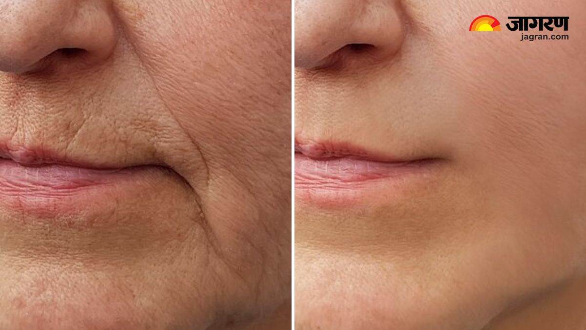 5 home remedies will keep your skin tight as you age you will not have to worry about loose and sagging skin