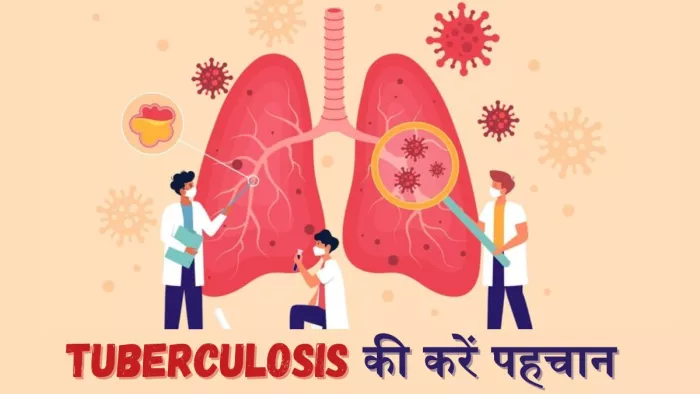 टीबी के इन लक्षणों से वक्त रहते करें इसकी पहचान