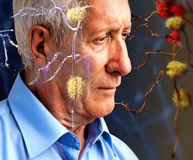 वैज्ञानिकों की मानें तो एक पौधे का रस अल्जाइमर से लड़ने में मददगार हो सकता है। (File Photo)