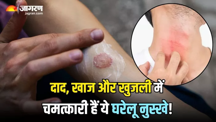दाद, खाज और खुजली में रामबाण हैं ये घरेलू नुस्खे (Image Source: Freepik)