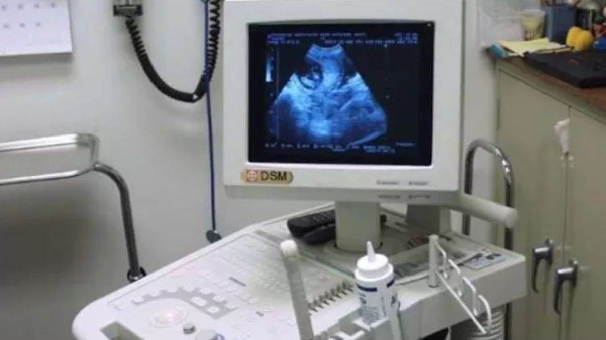 Jharkhand News: अल्ट्रासोनोग्राफी केंद्रों को हर महीने जमा करना होगा ये फॉर्म, तारीख भी फिक्‍स; नहीं करने पर...