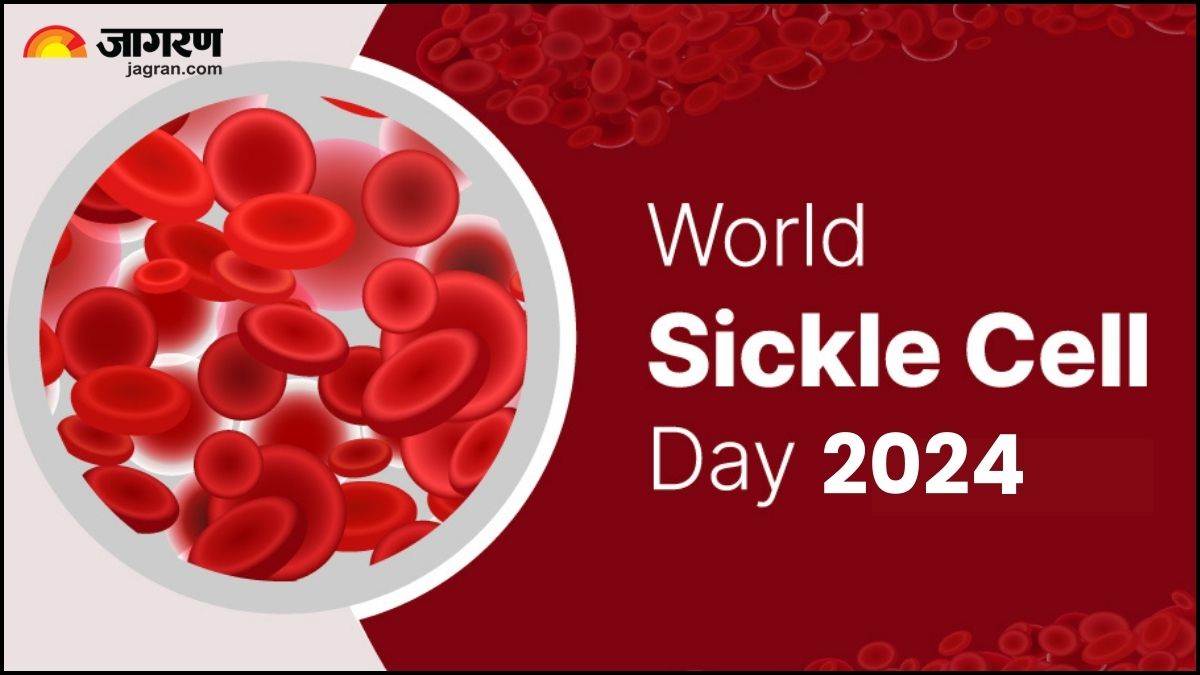 world sickle cell day 2024 what is sickle cell disease know the symptoms prevention and treatment in hindi