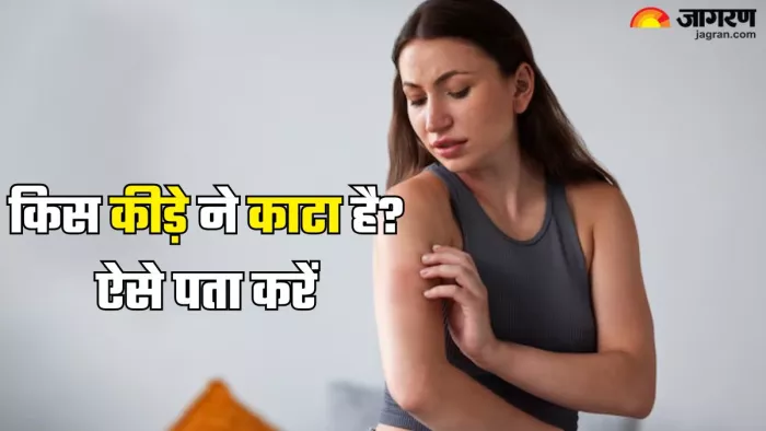 जानिए किस कीड़े के काटने पर कैसा होता है असर (Picture Credit-Freepik)