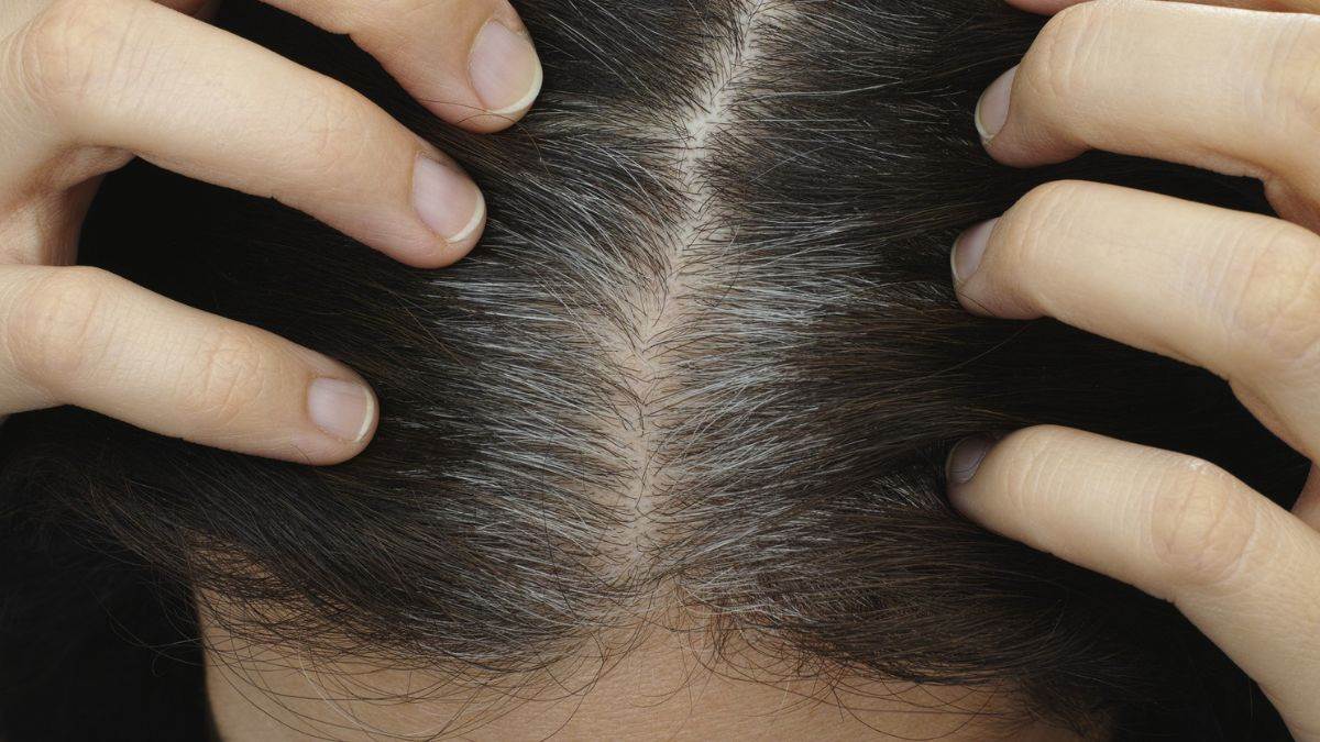 https://www.jagranimages.com/images/newimg/18062025/18_06_2025-prevent_premature_gray_hair_23966392.jpg