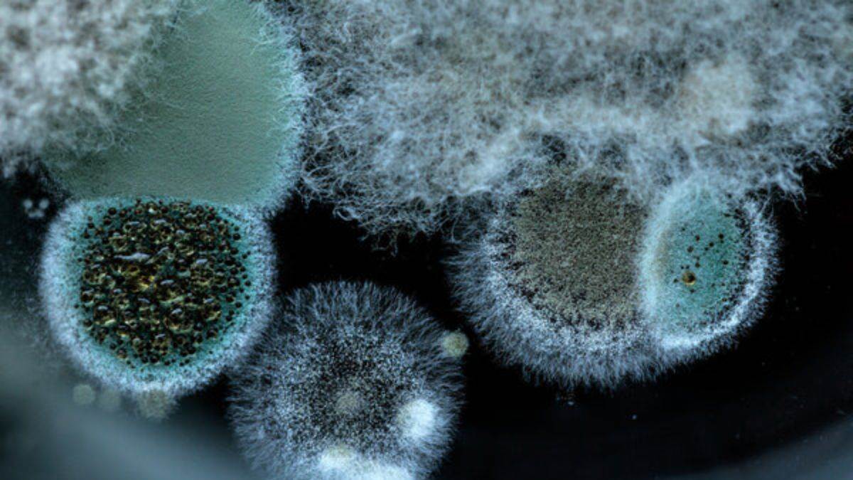 https://www.jagranimages.com/images/newimg/18072025/18_07_2025-black_fungus_23987384.jpg