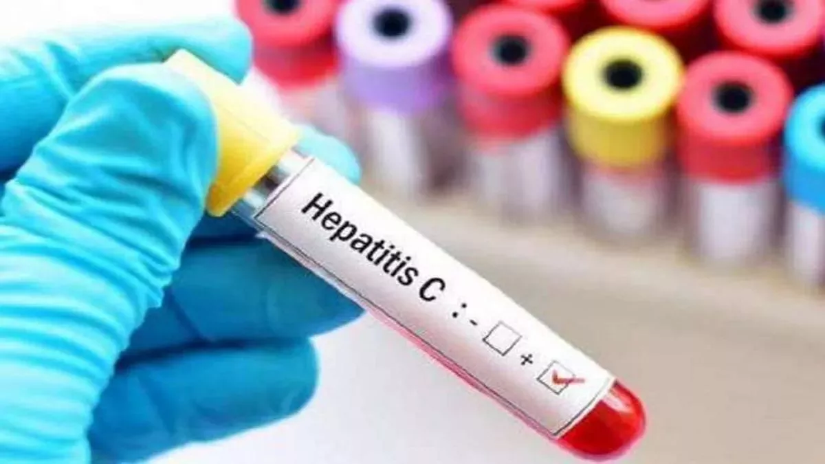 Hepatitis: सीतापुर में हेपेटाइटिस संक्रमण पर स्वास्थ्य विभाग गंभीर, चलेगा विशेष जांच अभियान