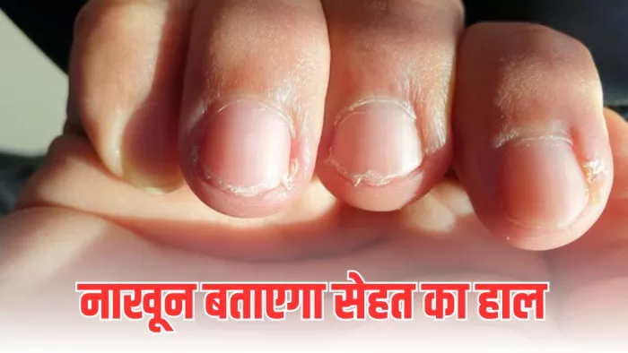 नाखूनों में नजर आने वाले इन लक्षणों को न करें अनदेखा (Image Credit- Freepik)