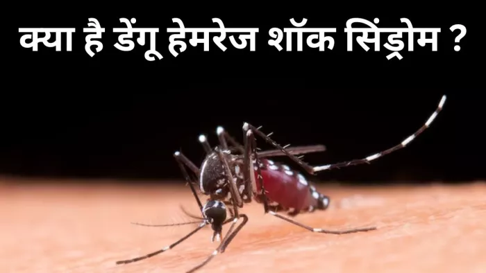 क्या है डेंगू हेमरेज शॉक सिंड्रोम, जिससे गई डॉक्टर की जान
