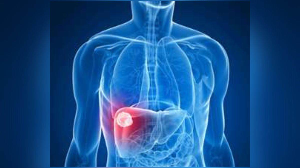 https://www.jagranimages.com/images/newimg/18112022/18_11_2022-gallbladder_cancer_23211333.jpg