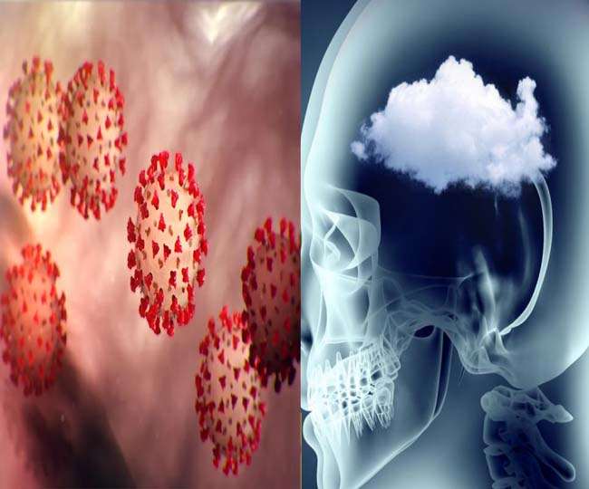 Symptoms of brain fog found in 58 percent of Covid 19 patients Jagran  Special