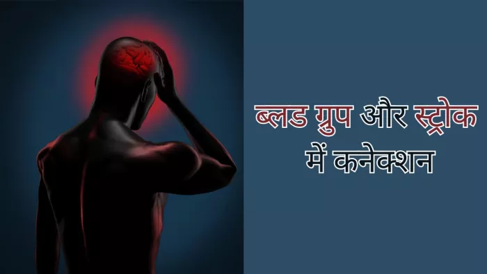 ब्लड ग्रुप बता है सकता है आपको स्ट्रोक का कितना खतरा