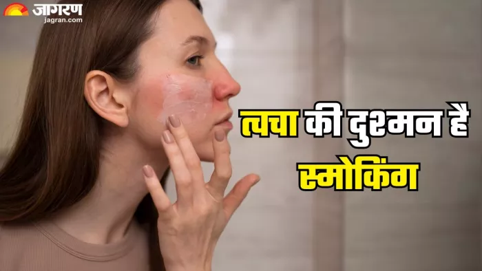 स्किन के लिए हानिकारक स्मोकिंग (Picture Credit- Freepik)