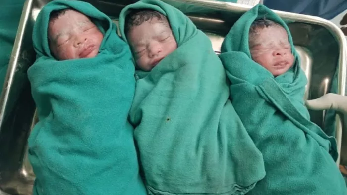 Noida: महिला ने एक साथ 3 बच्चियों को दिया जन्म